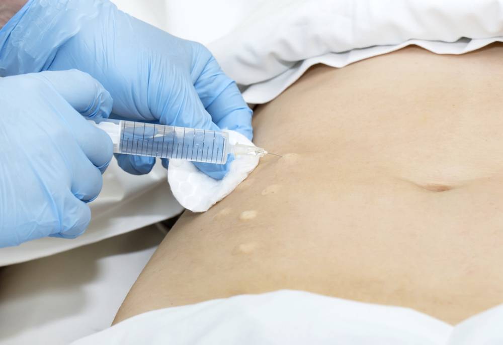 Mesoterapia Antalgica